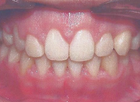 CASE5AFTER